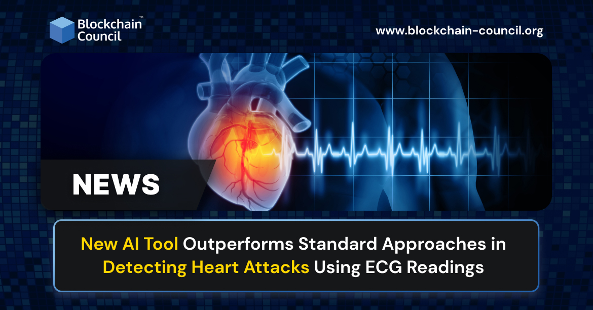 New AI Tool Outperforms Standard Approaches in Detecting Heart Attacks Using ECG Readings